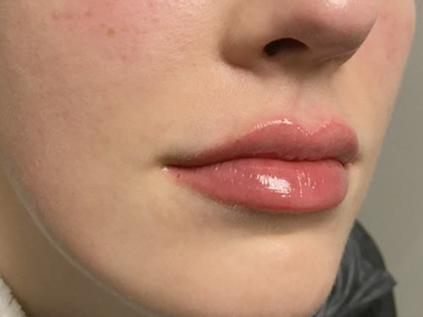 Injectables And Fillers 05