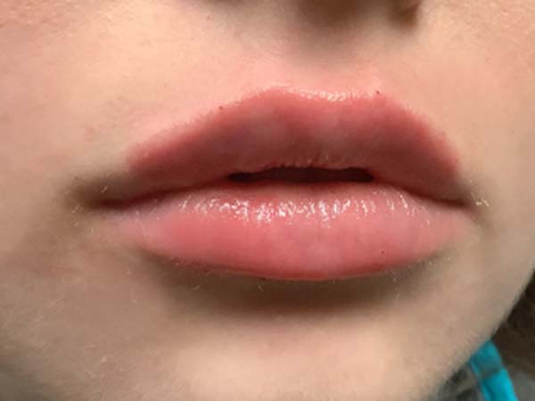 Injectables And Fillers 05