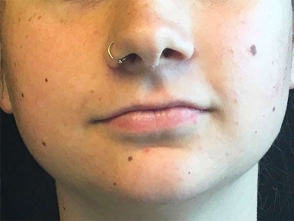 Injectables And Fillers 01