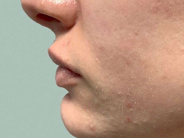 Injectables And Fillers 05