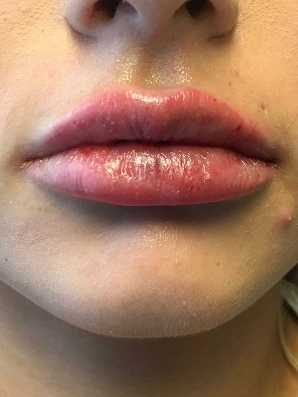 Injectables And Fillers 71