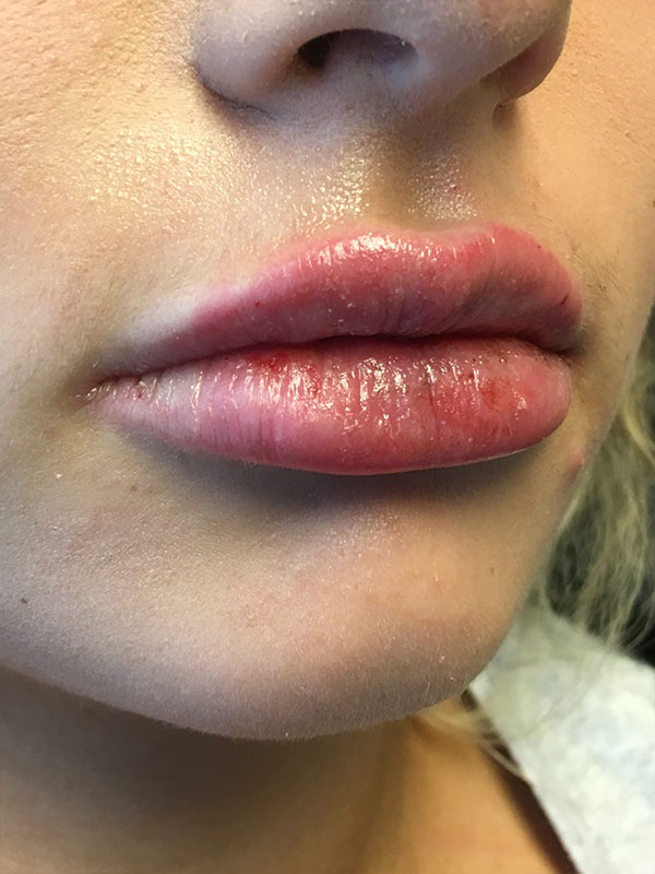 Injectables And Fillers 03