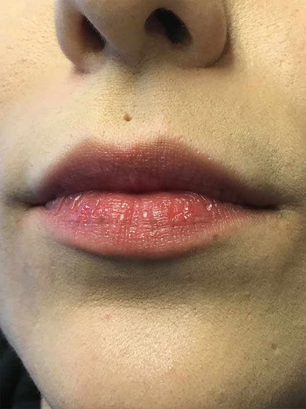 Injectables And Fillers 01