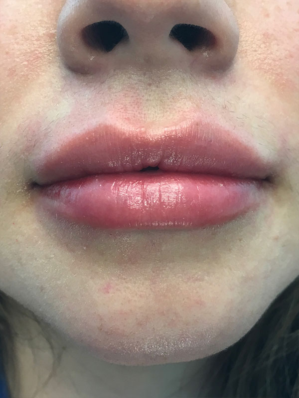 Injectables And Fillers 73