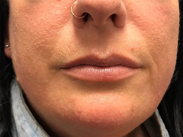 Injectables And Fillers 01