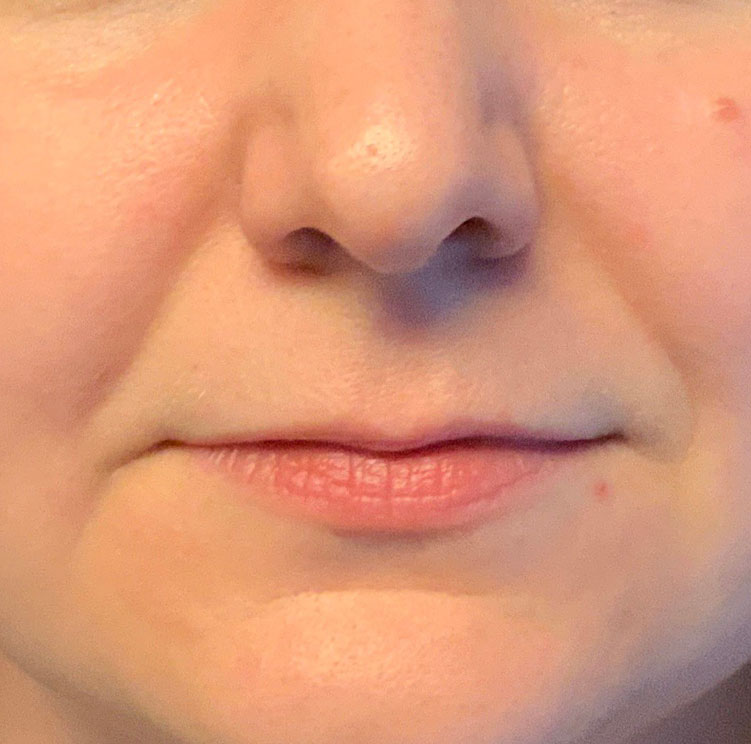 Injectables And Fillers 01