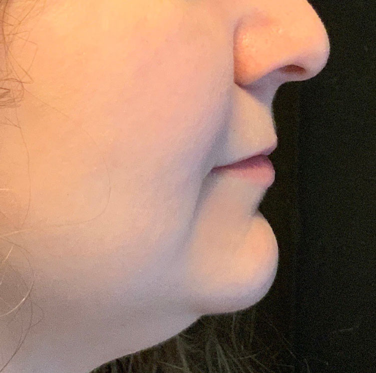 Injectables And Fillers 05