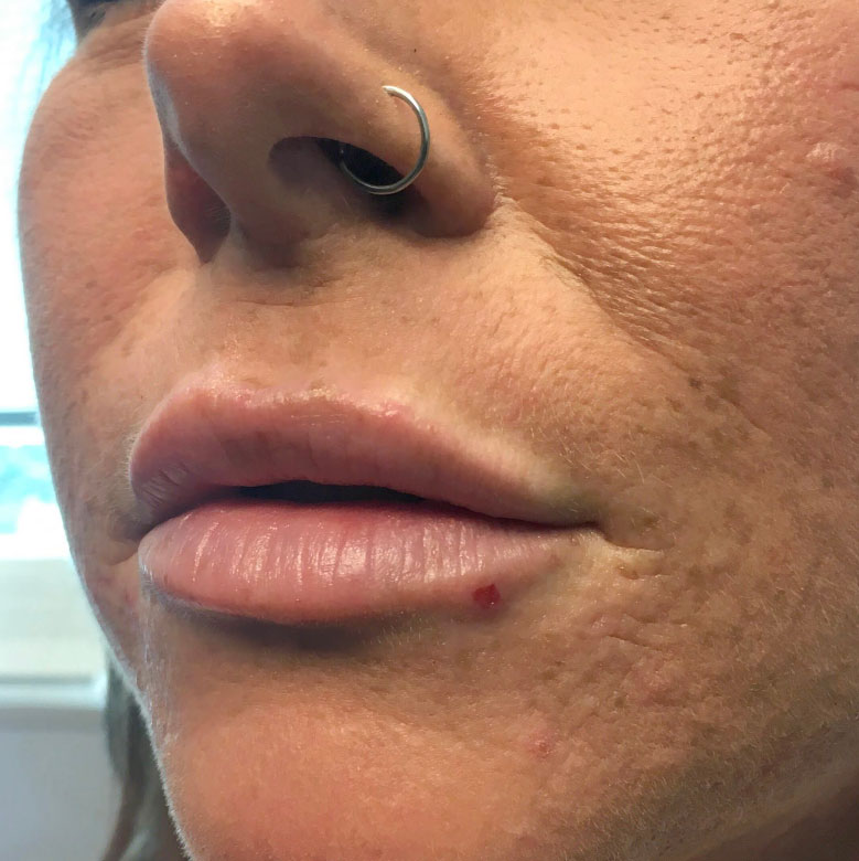 Injectables And Fillers 03