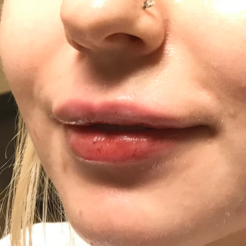 Injectables And Fillers 03