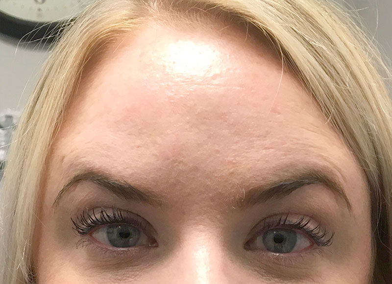 Injectables And Fillers 03