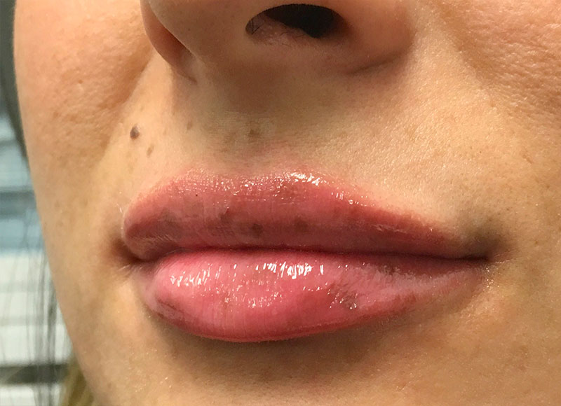 Injectables And Fillers 03