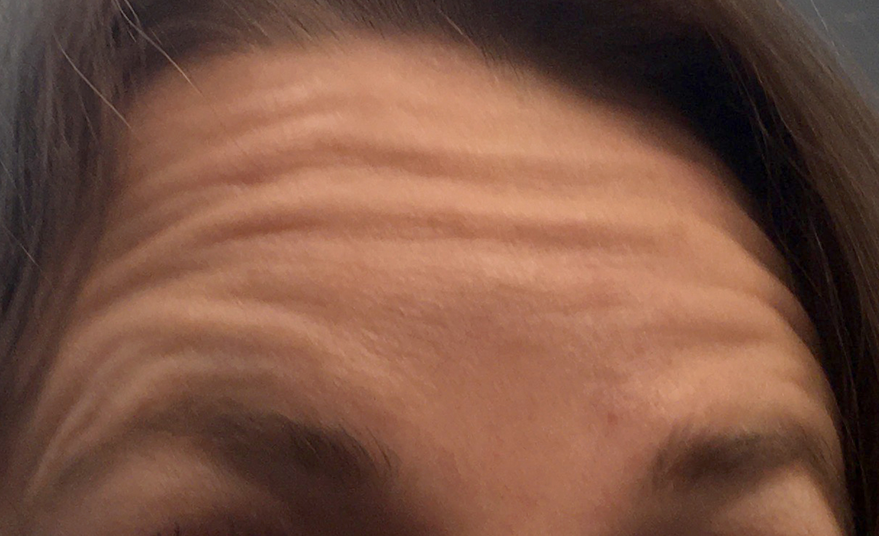 Injectables And Fillers 01