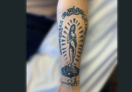 Laser Tattoo Removal 01