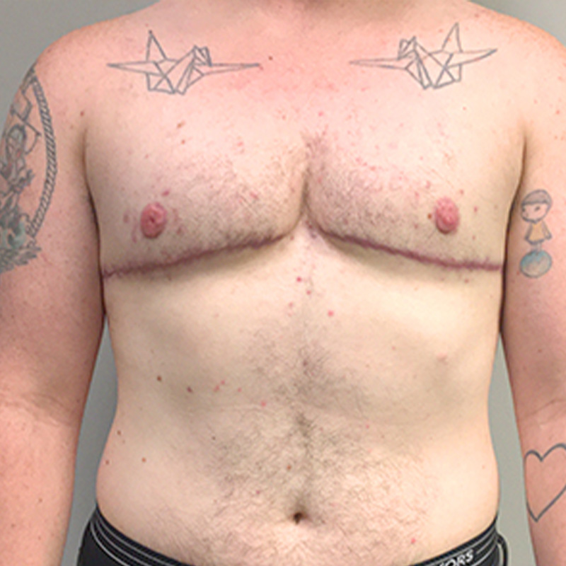 45 Tattoo Artists Who Helped People Beautifully Cover Up Their Scars