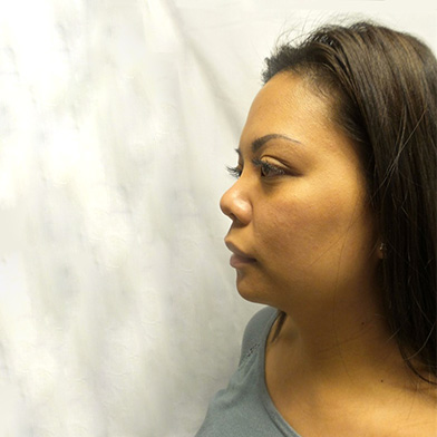 Hair Restoration Removed Photos Deletable 05