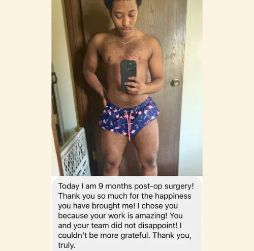 Are you a candidate for FTM top surgery